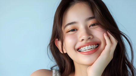 Niềng răng - Phương pháp tối ưu cho thẩm mỹ nụ cười và bảo tồn răng thật