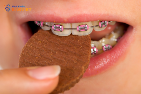 Chế độ ăn uống phù hợp cho người đang niềng răng