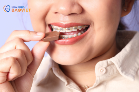 Chế độ ăn uống phù hợp cho người đang niềng răng