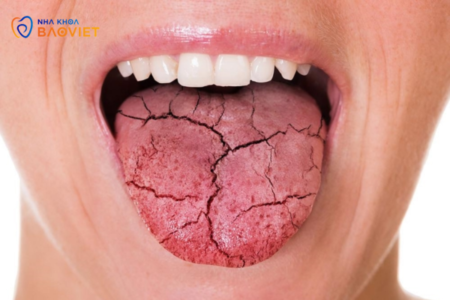 Những vấn đề răng miệng thường gặp ở người cao tuổi