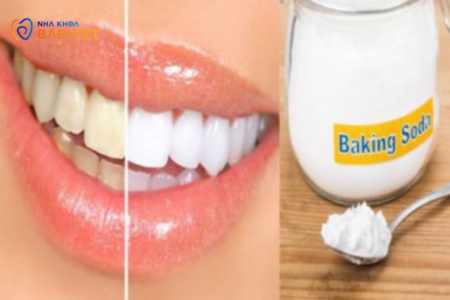 Cách Làm Sáng Răng Tại Nhà Chỉ Với Baking Soda