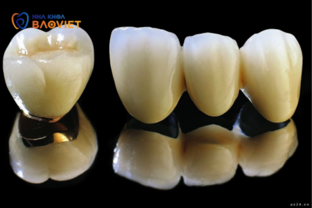 Quy trình bọc răng sứ diễn ra như thế nào?