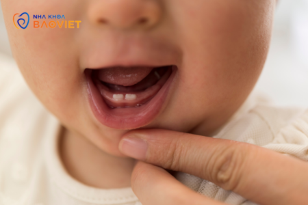 Thời điểm nào thì nên thay răng sữa cho bé
