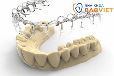 niềng răng khay Invisalign