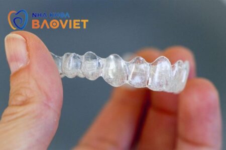 niềng răng khay 3D Smile Aligren