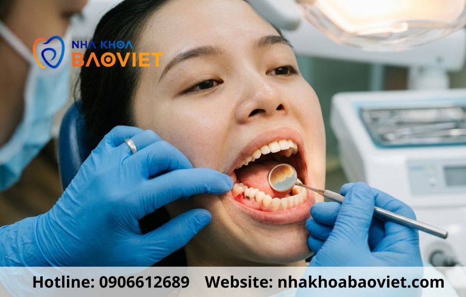 Nhổ răng khôn bằng máy siêu âm Piezotome giá bao nhiêu?