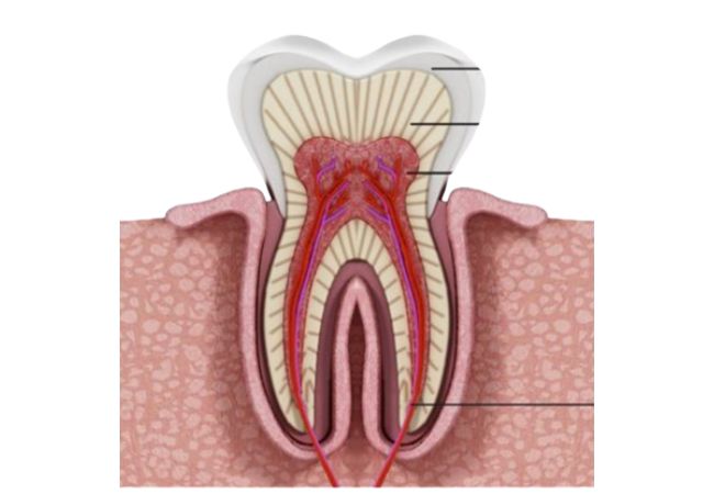 Điều trị tủy răng