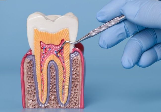 Điều trị tủy răng