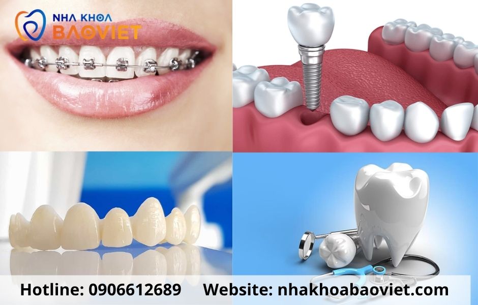 Nha Khoa Bảo Việt - Số 8 Vũ Thạnh