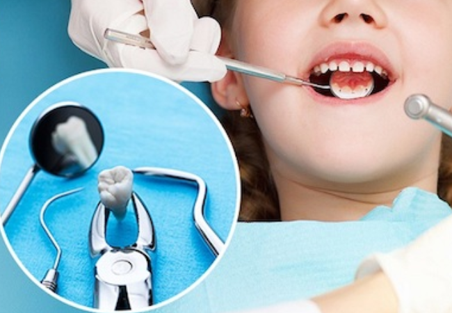 0.Bao nhiêu tuổi thì nên can thiệp đóng khoảng răng thưa để đạt hiệu quả tốt nhất?