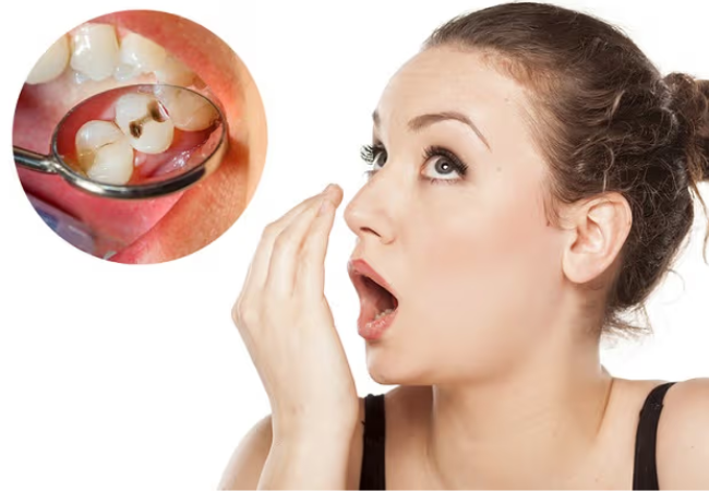 2.Bao nhiêu tuổi thì nên can thiệp đóng khoảng răng thưa để đạt hiệu quả tốt nhất?