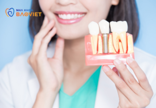 4.Giá cấy implant phụ thuộc vào những yếu tố nào? Hướng dẫn cách tối ưu chi phí