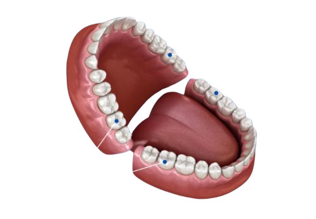 nhổ răng số 8