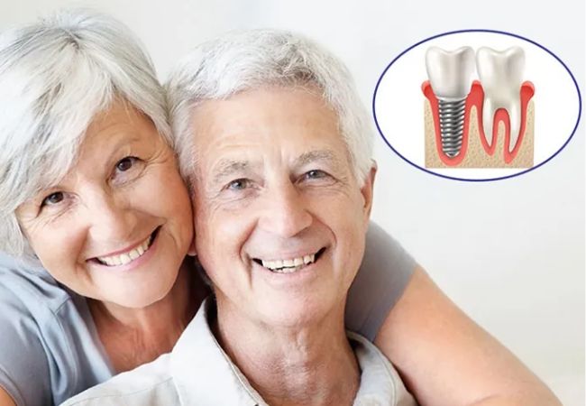 Implant