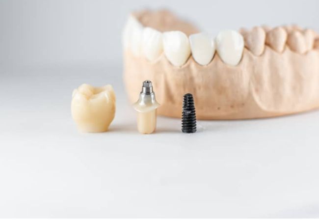 Implant