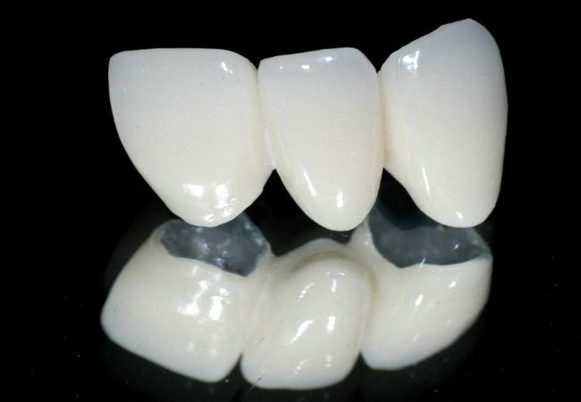 Implant