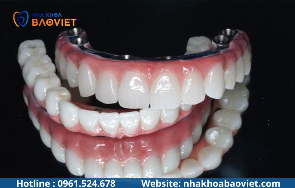 Implant