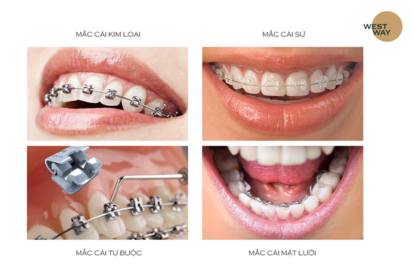 Nụ cười đẹp và sự tự tin