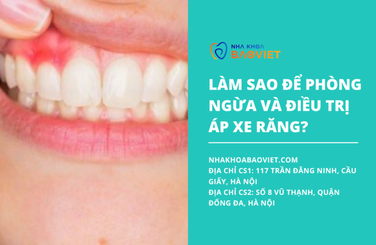 Làm sao để phòng ngừa và điều trị áp xe răng?