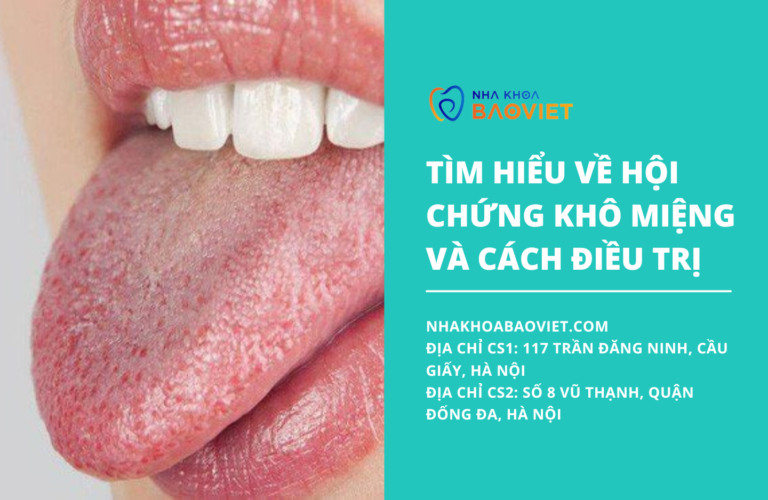 Tìm hiểu về hội chứng khô miệng và cách điều trị