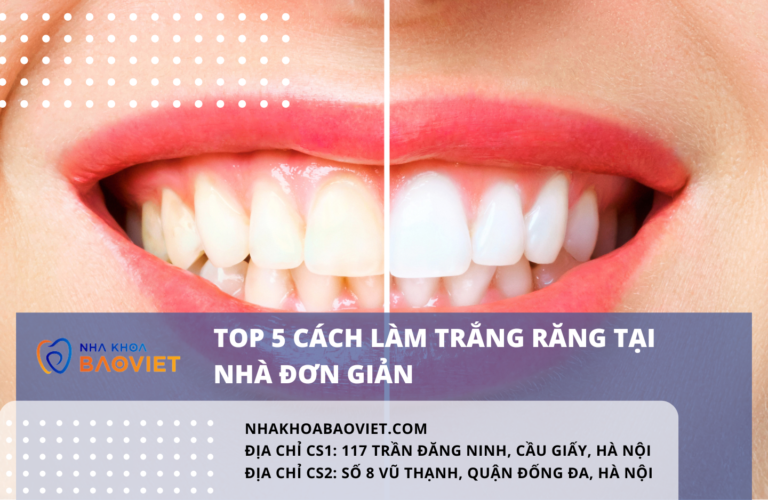 Top 5 cách làm trắng răng tại nhà đơn giản