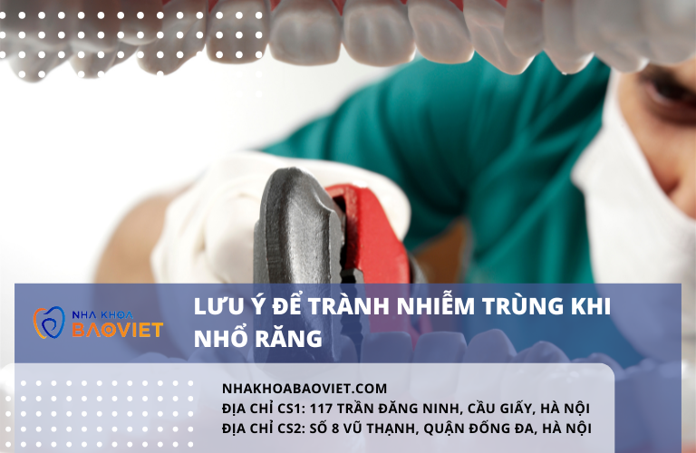 Lưu ý để tránh nhiễm trùng khi nhổ răng