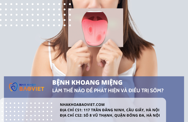 Bệnh Khoang Miệng: Làm Thế Nào Để Phát Hiện Và Điều Trị Sớm?