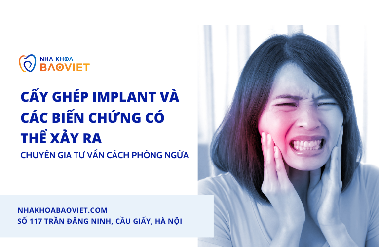 Cấy Ghép Implant Và Các Biến Chứng Có Thể Xảy Ra: Chuyên Gia Tư Vấn Cách Phòng Ngừa