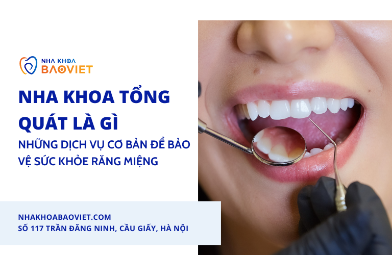 Nha Khoa Tổng Quát Là Gì