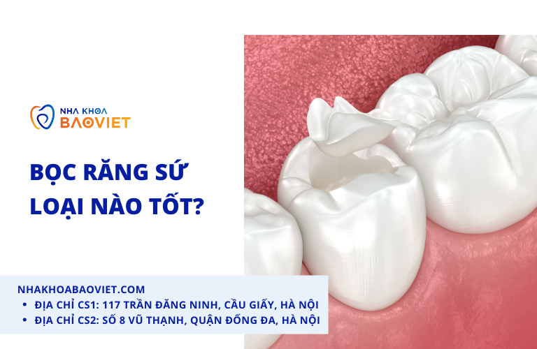 Bọc răng sứ loại nào tốt?