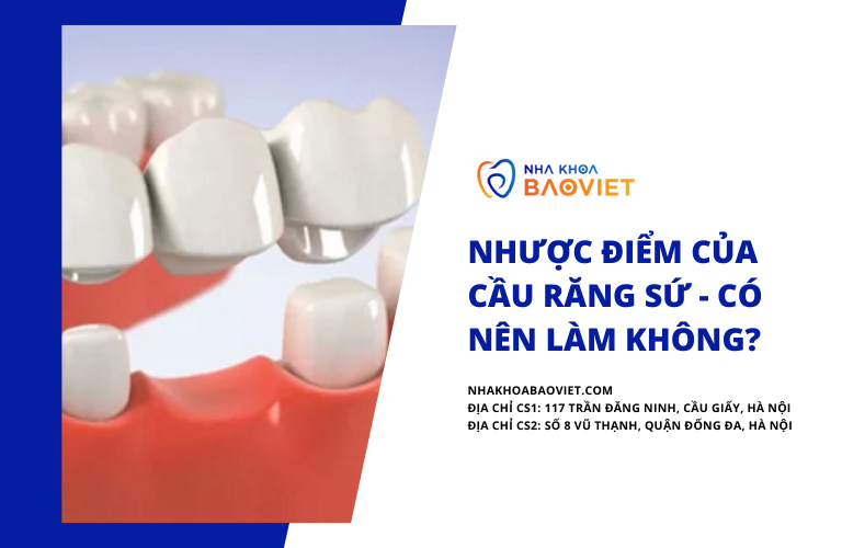 Nhược điểm của cầu răng sứ - Có nên làm không?