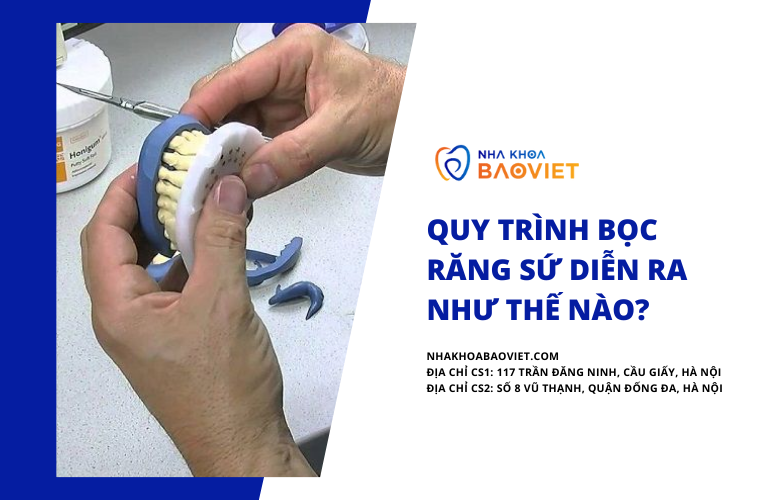 Quy trình bọc răng sứ diễn ra như thế nào?