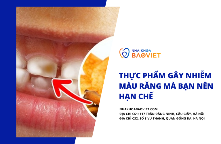 Thực phẩm gây nhiễm màu răng mà bạn nên hạn chế