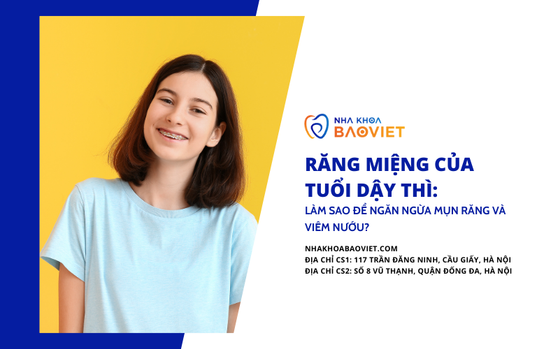 Răng Miệng Của Tuổi Dậy Thì: Làm Sao Để Ngăn Ngừa Mụn Răng Và Viêm Nướu?