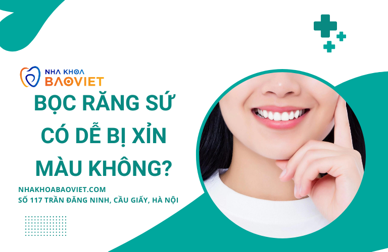 Bọc Răng Sứ Có Dễ Bị Xỉn Màu Không? Lý Do Và Phương Pháp Giữ Gìn Hiệu Quả