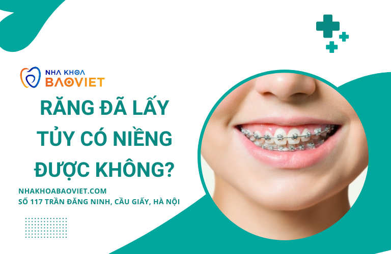 Răng Đã Lấy Tủy Có Thể Thực Hiện Chỉnh Nha Không?