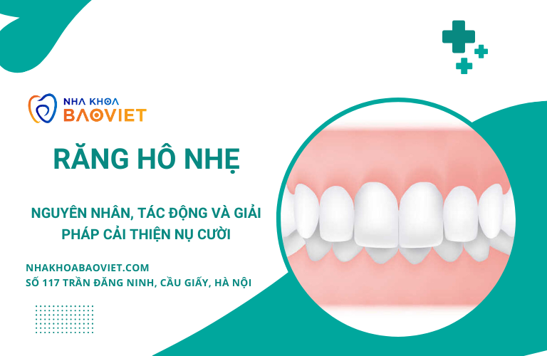 Răng Hô Nhẹ: Nguyên Nhân, Tác Động Và Giải Pháp Cải Thiện Nụ Cười