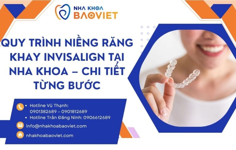 Quy trình niềng răng khay Invisalign tại nha khoa – Chi tiết từng bước
