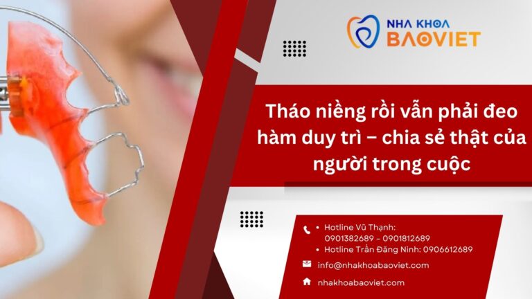 Tháo niềng rồi vẫn phải đeo hàm duy trì – chia sẻ thật của người trong cuộc