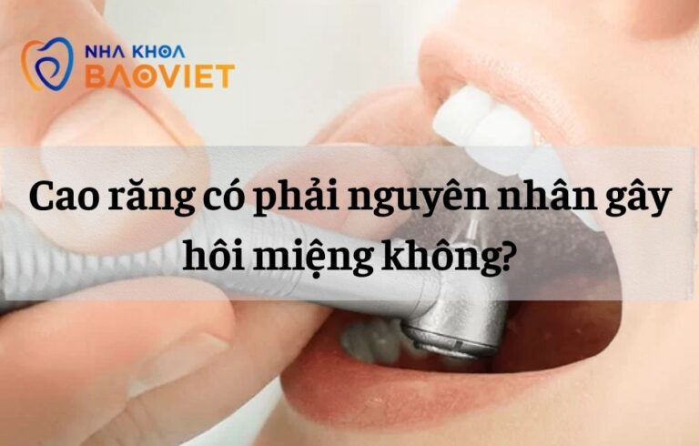 Cao răng có phải nguyên nhân gây hôi miệng không?