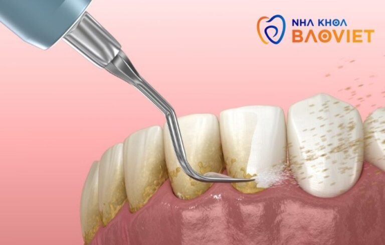 nha khoa bao viet template 940 x 600 px 15 1