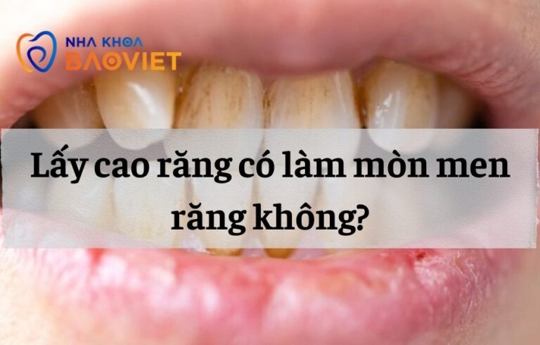 nha khoa bao viet template 940 x 600 px 16 1