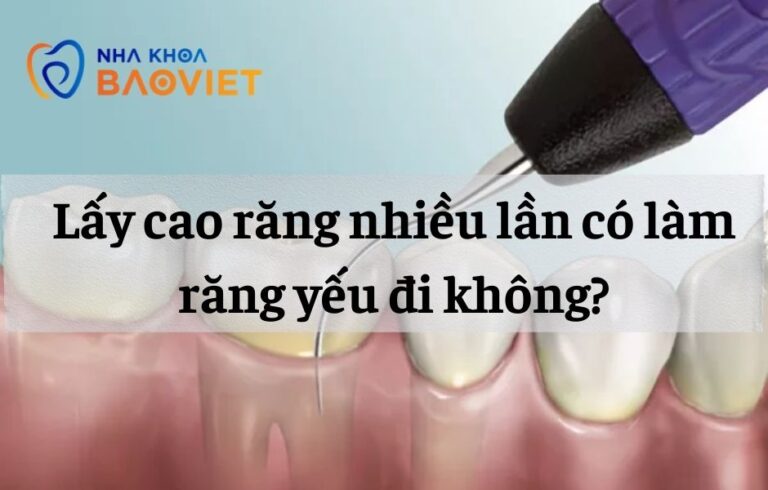 nha khoa bao viet template 940 x 600 px 17 1