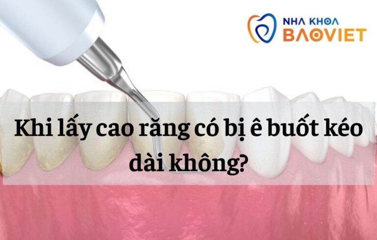 nha khoa bao viet template 940 x 600 px 4 4
