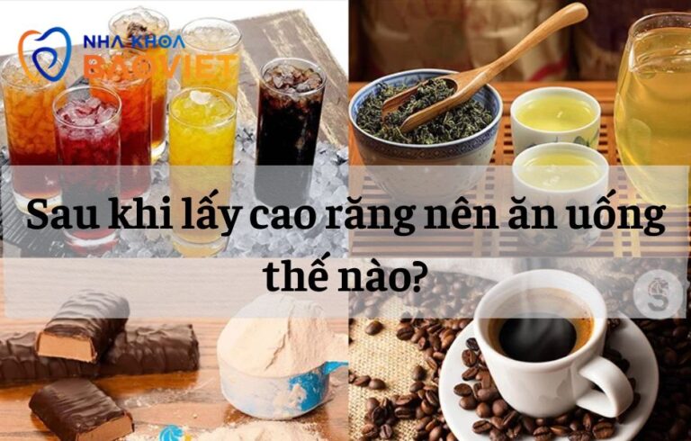nha khoa bao viet template 940 x 600 px 5 4