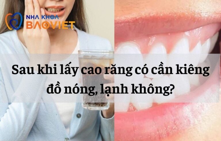 Có cần kiêng ăn đồ nóng, lạnh sau khi lấy cao răng không?