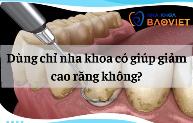 nha khoa bao viet template 940 x 600 px 7 4