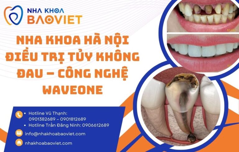 Nha Khoa Hà Nội Điều Trị Tủy Không Đau – Công Nghệ WaveOne