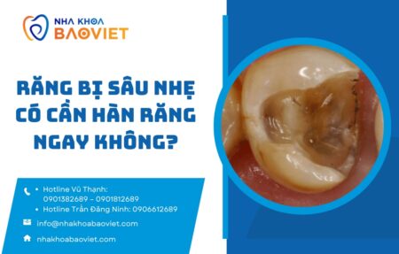 nha khoa bao viet template 940 x 600 px 2 2