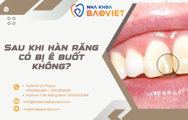 Sau khi hàn răng có bị ê buốt không?